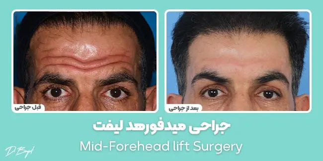 جراحة تجميلية للرجال