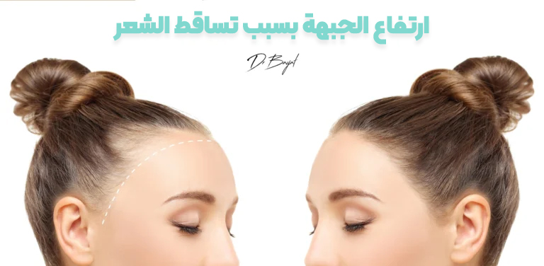 ما هي الخيارات الدائمة