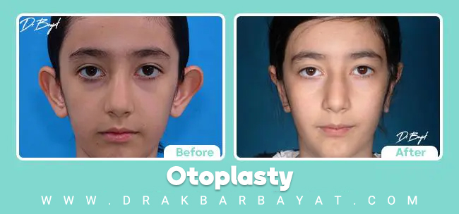 جراحة التوبلاستي|في دبي والشارقة، الإمارات العربية المتحدة