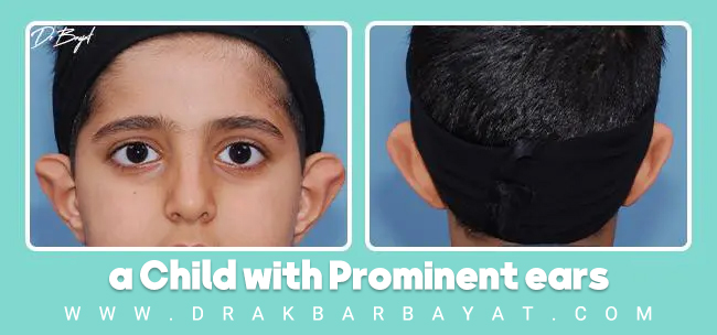 هذه الأذن البارزة بين الأطفال