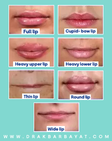 الشفة وأنواعها