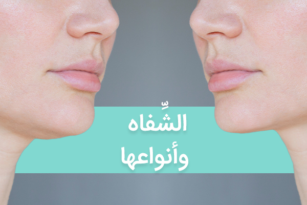 الشفة وأنواعها