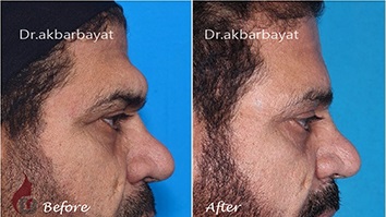 الجبهة البارزة Dr Akbar Bayat