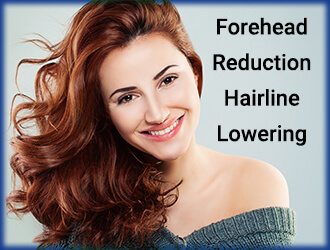 Forehead Reduction Hairline Lowering