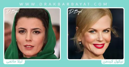 لیفت سانترال لب چیست؟