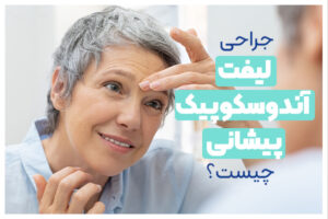 جراحی لیفت اندوسکوپیک پیشانی چیست؟