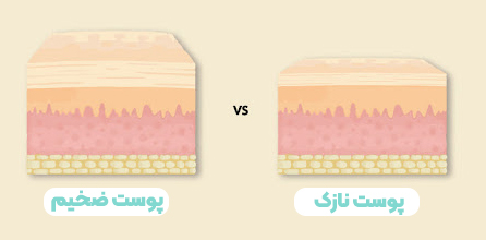 مقایسه چین دینامیک و استاتیک پیشانی