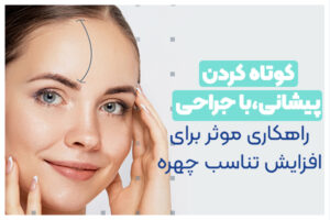 کوتاه کردن پیشانی بهترین جراحی زیبایی