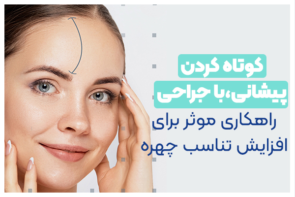 کوتاه کردن پیشانی بهترین جراحی زیبایی