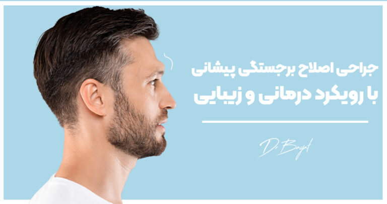 جراحی اصلاح برجستگی پیشانی با رویکرد درمانی و زیبایی(جدید ترین متد سال 2025)