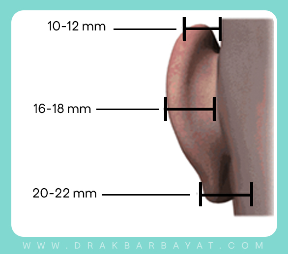غیر قرینگی گوش 