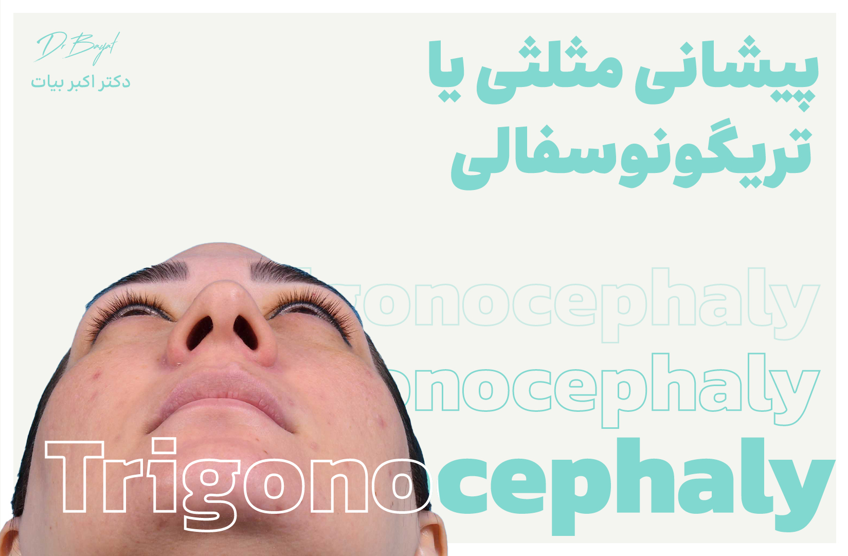پیشانی مثلثی