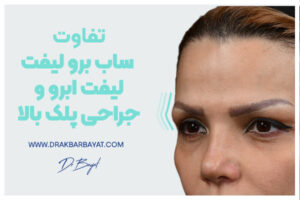 تفاوت ساب‌برو لیفت، لیفت ابرو و جراحی پلک بالا