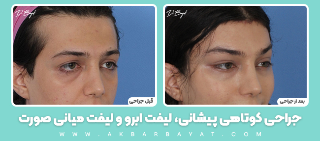 زنانه سازی صورت