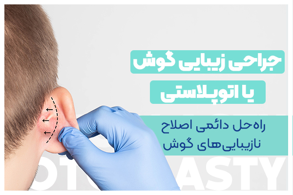 جراحی زیبایی گوش در سعادت آباد تهران