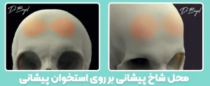 محل ایجاد شاخ پیشانی درقسمت بالای استخوان پیشانی