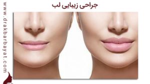 جراحی زیبایی لب | کلینیک زیبایی دکتر اکبر بیات